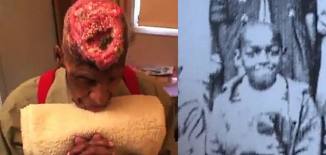 human radiation experiments 1